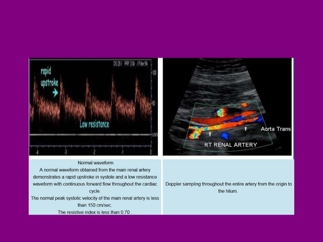 Doppler ultrasound in renal patients | PPT | Heart and Cardiovascular ...