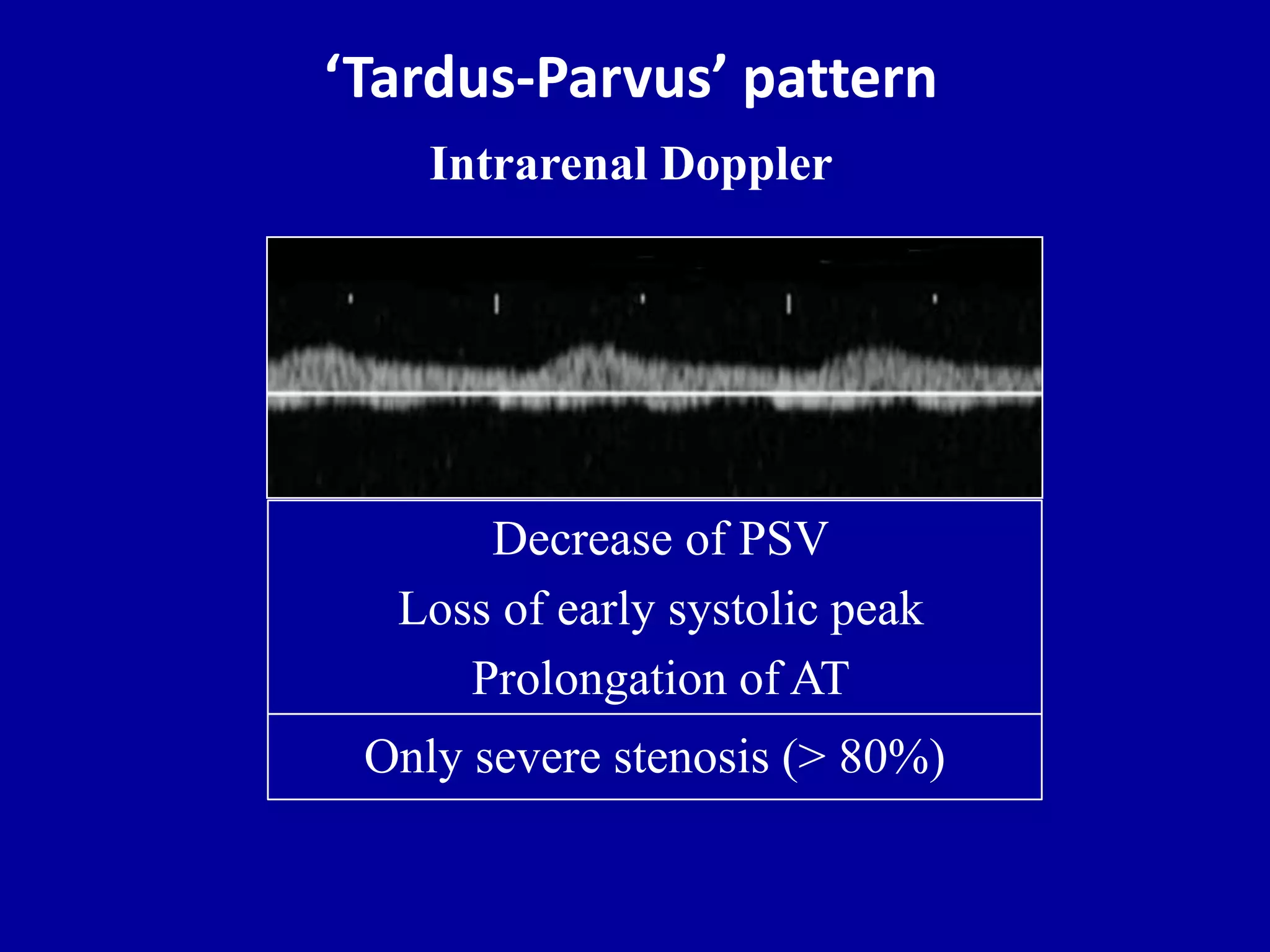Doppler ultrasound in transplant renal artery stenosis | PPTX