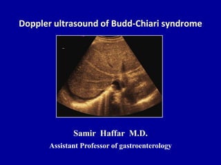 Doppler ultrasound of Budd-Chiari syndrome
Samir Haffar M.D.
Assistant Professor of gastroenterology
 