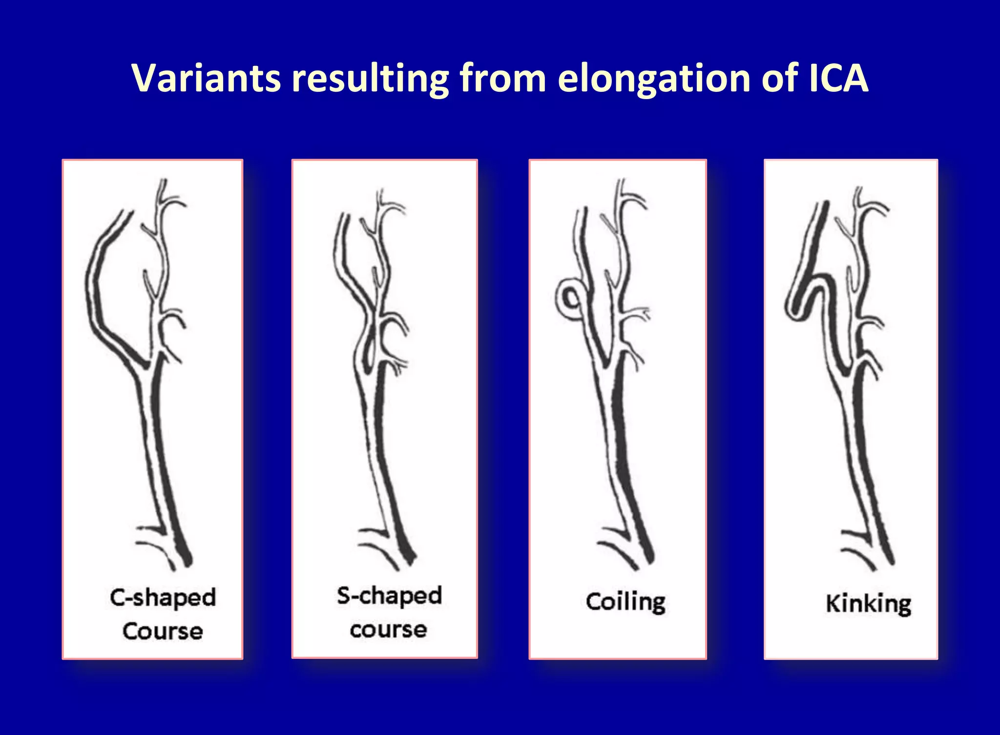 Variants resulting from elongation of ICA
 
