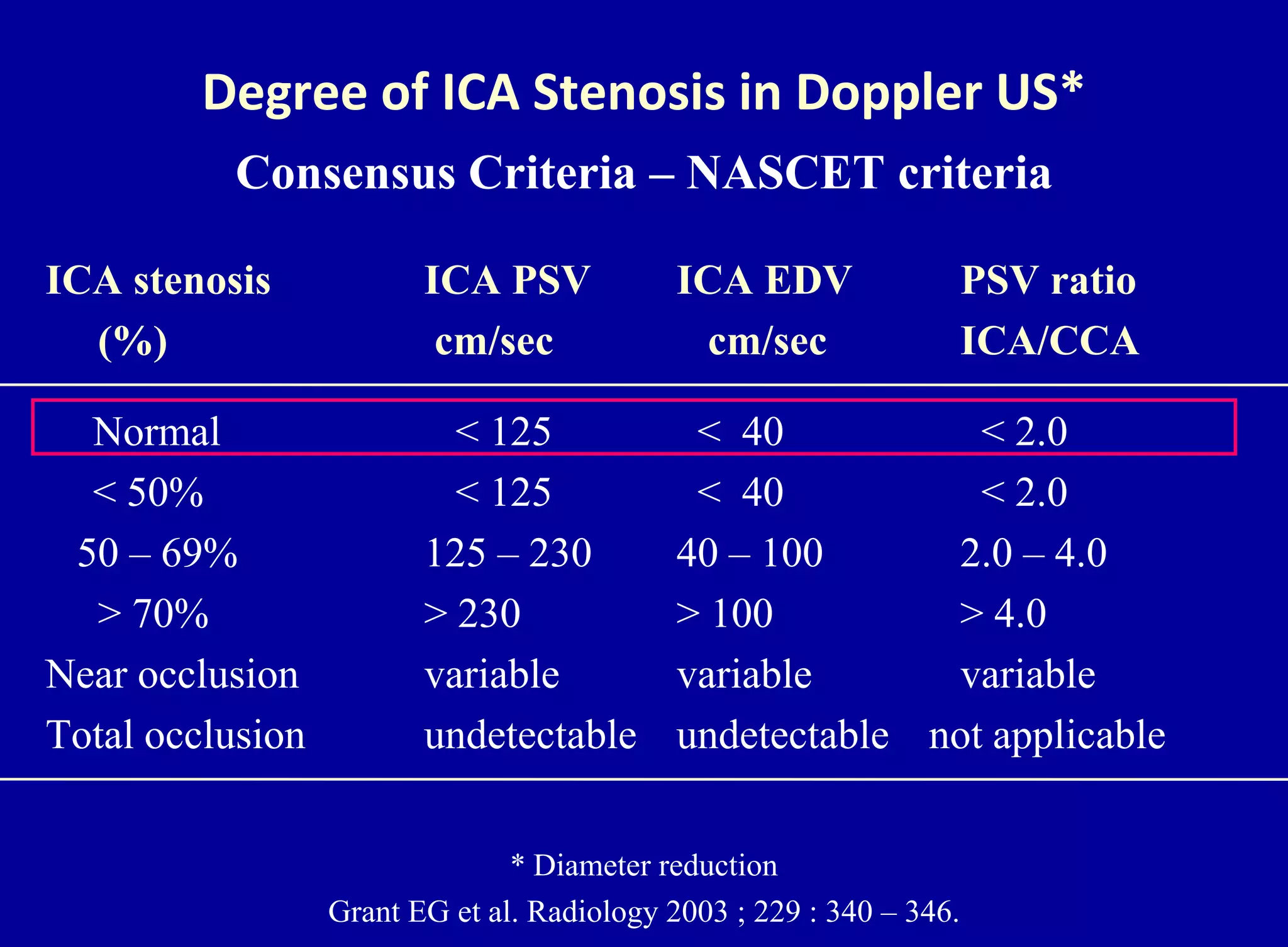 Degree of ICA Stenosis in Doppler US*
Consensus Criteria – NASCET criteria
ICA stenosis ICA PSV ICA EDV PSV ratio
(%) cm/sec cm/sec ICA/CCA
Normal < 125 < 40 < 2.0
< 50% < 125 < 40 < 2.0
50 – 69% 125 – 230 40 – 100 2.0 – 4.0
> 70% > 230 > 100 > 4.0
Near occlusion variable variable variable
Total occlusion undetectable undetectable not applicable
* Diameter reduction
Grant EG et al. Radiology 2003 ; 229 : 340 – 346.
 