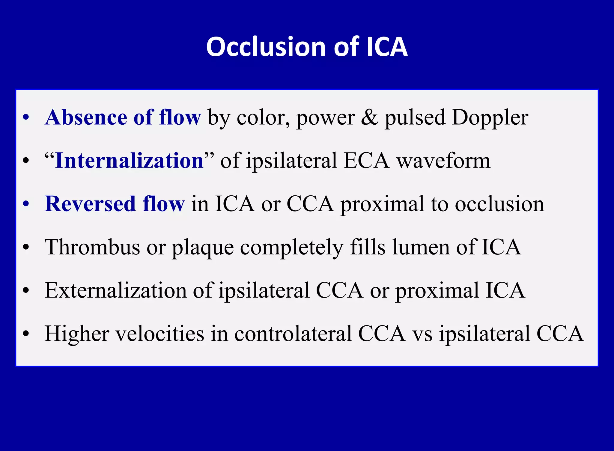 Occlusion of ICA
• Absence of flow by color, power & pulsed Doppler
• “Internalization” of ipsilateral ECA waveform
• Reversed flow in ICA or CCA proximal to occlusion
• Thrombus or plaque completely fills lumen of ICA
• Externalization of ipsilateral CCA or proximal ICA
• Higher velocities in controlateral CCA vs ipsilateral CCA
 