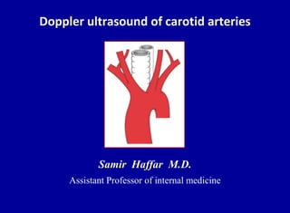 Doppler ultrasound of carotid arteries
Samir Haffar M.D.
Assistant Professor of internal medicine
 