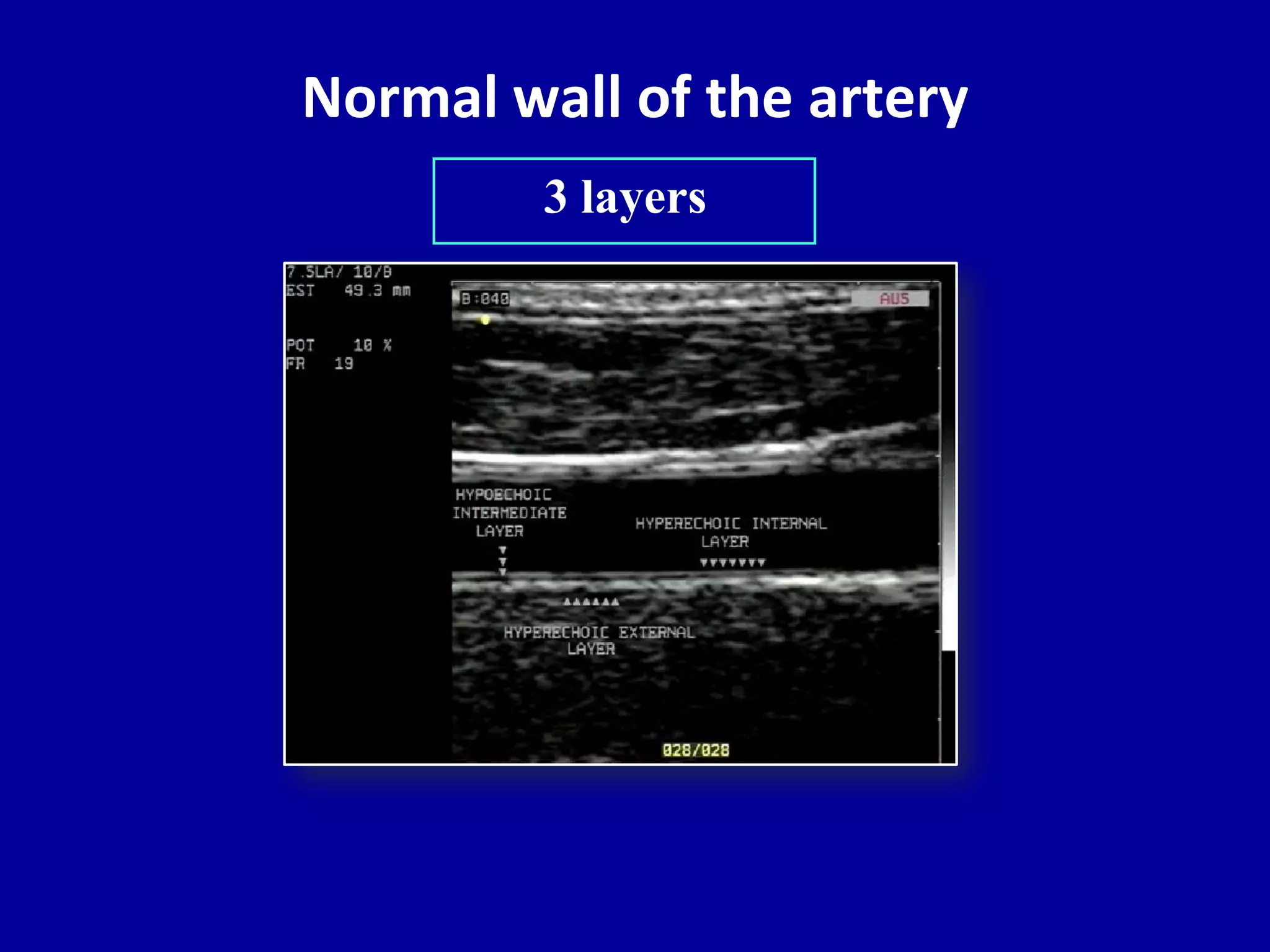 Doppler ultrasound of lower limb arteries | PPTX