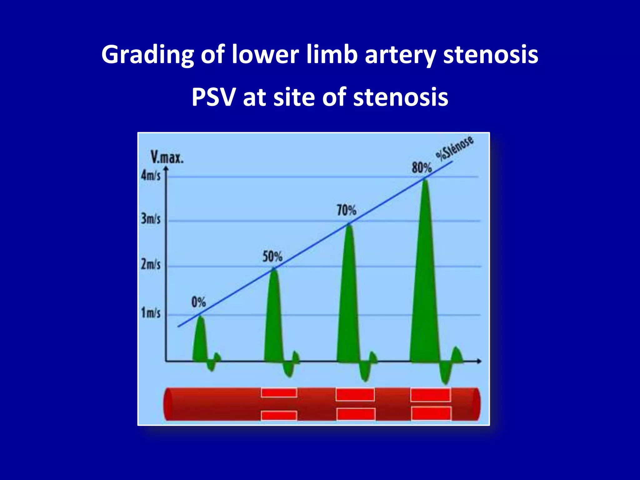 Doppler ultrasound of lower limb arteries | PPTX