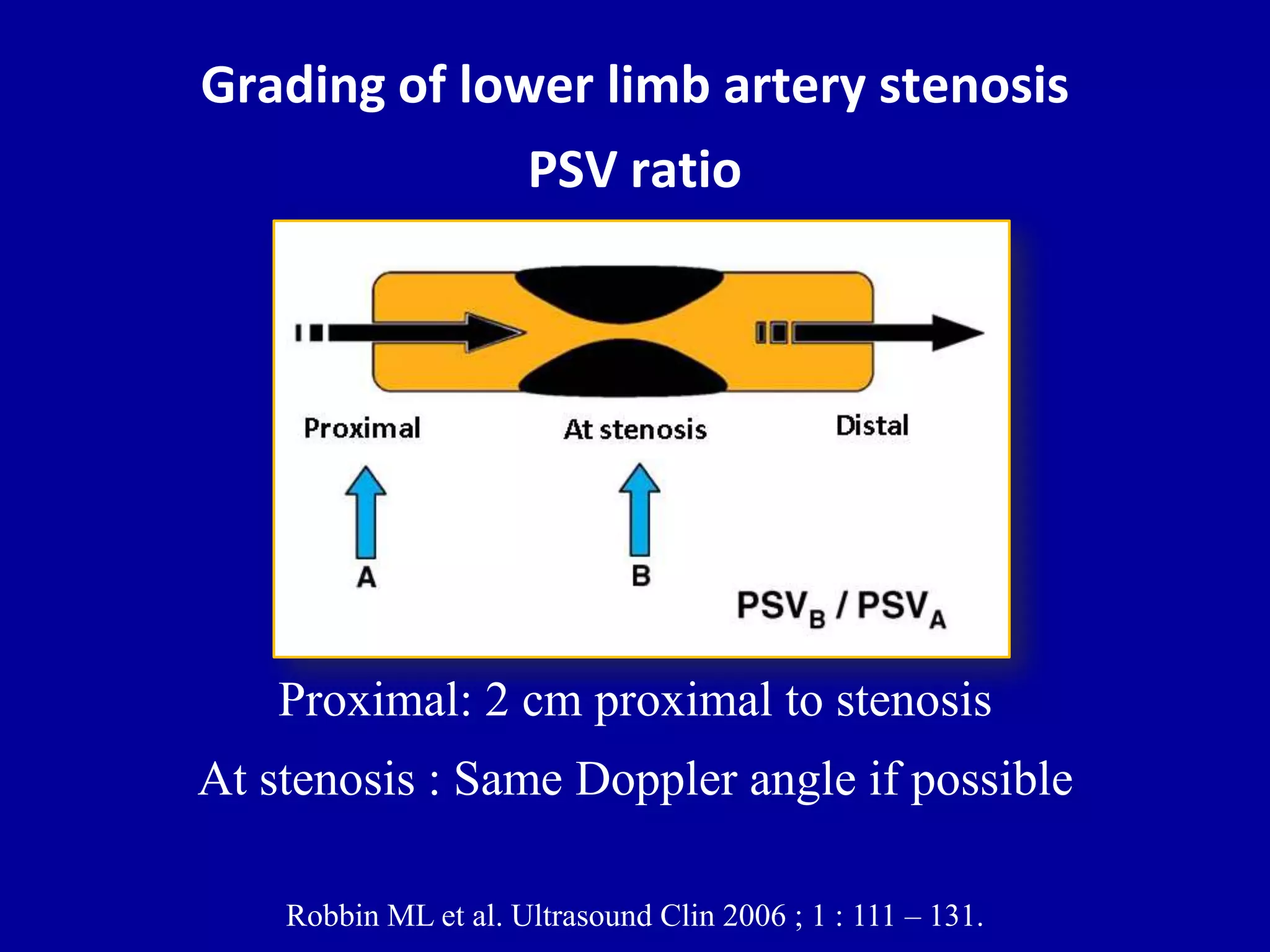 Doppler ultrasound of lower limb arteries | PPTX
