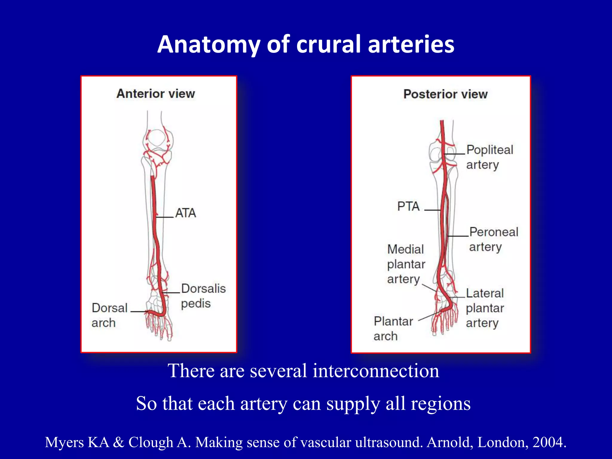 Doppler ultrasound of lower limb arteries | PPTX