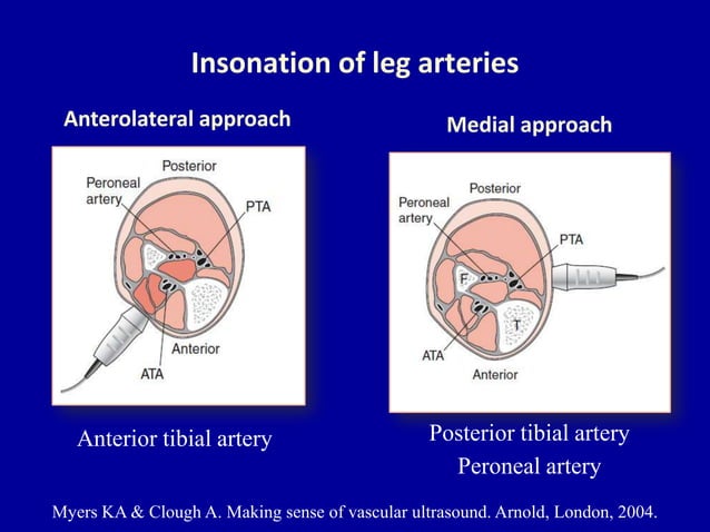 Doppler ultrasound of lower limb arteries | PPTX | Death, Injury, or ...
