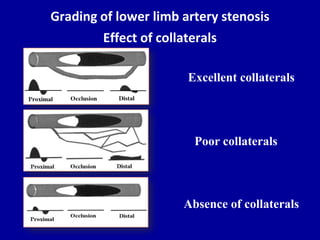 Doppler ultrasound of lower limb arteries | PPTX