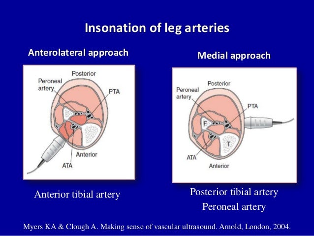 Doppler ultrasound of lower limb arteries