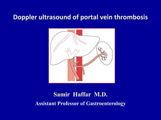 Doppler ultrasound of portal vein thrombosis
Samir Haffar M.D.
Assistant Professor of Gastroenterology
 