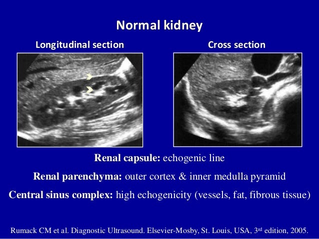 doppler ultrasound of the kidneys