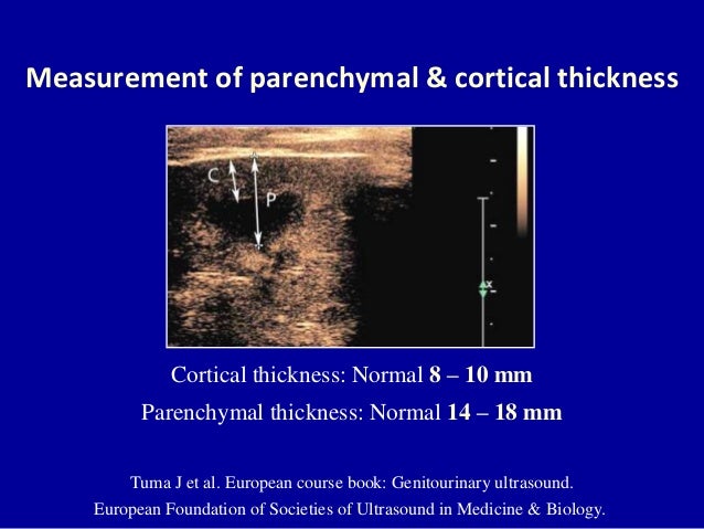 doppler-ultrasound-of-the-kidneys