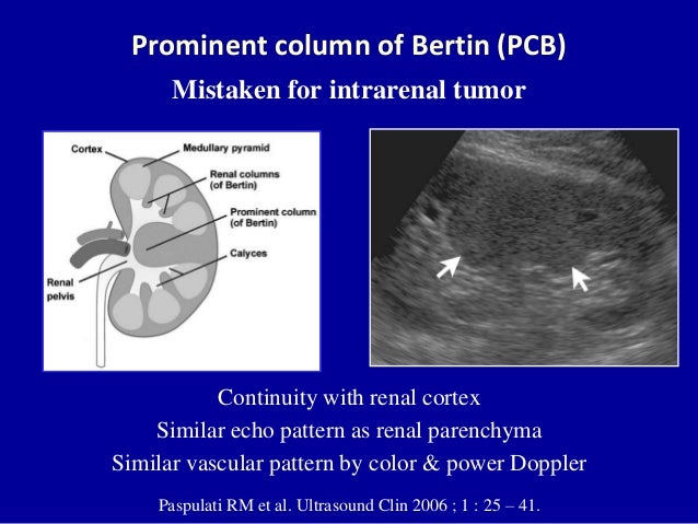 Pleural Cavity Wikipedia