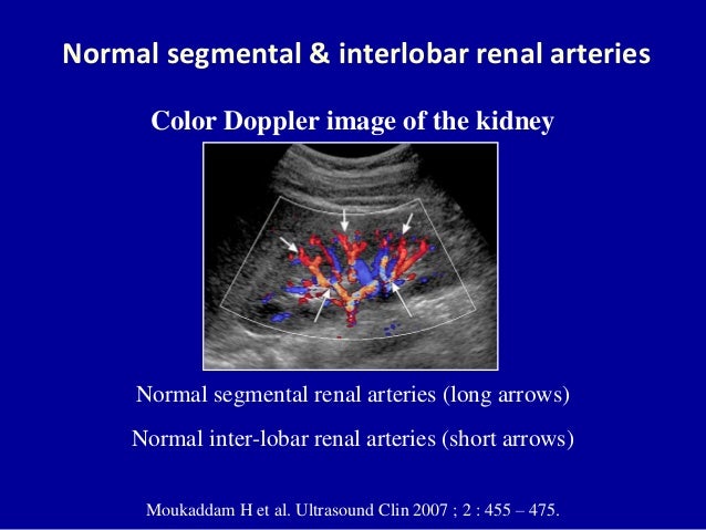 Doppler ultrasound of the kidneys