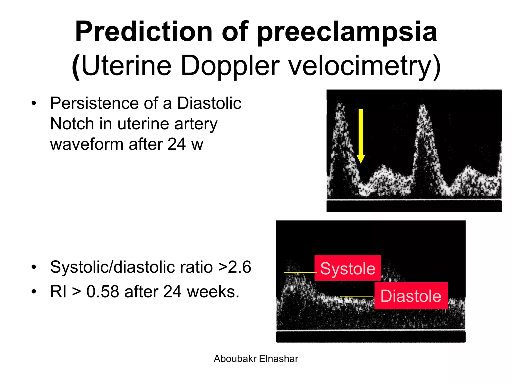 Umblical & uterine artery Doppler | PDF