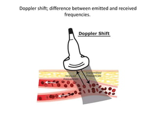 Doppler shift; difference between emitted and received
frequencies.
 