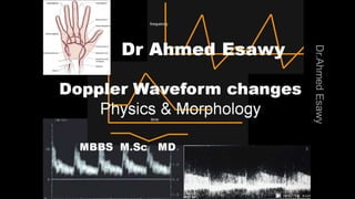 Duplex Ultrasound waveform changes