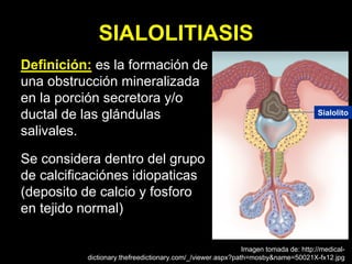 SIALOLITIASIS