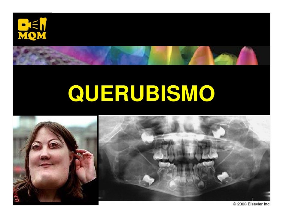 QUERUBISMO