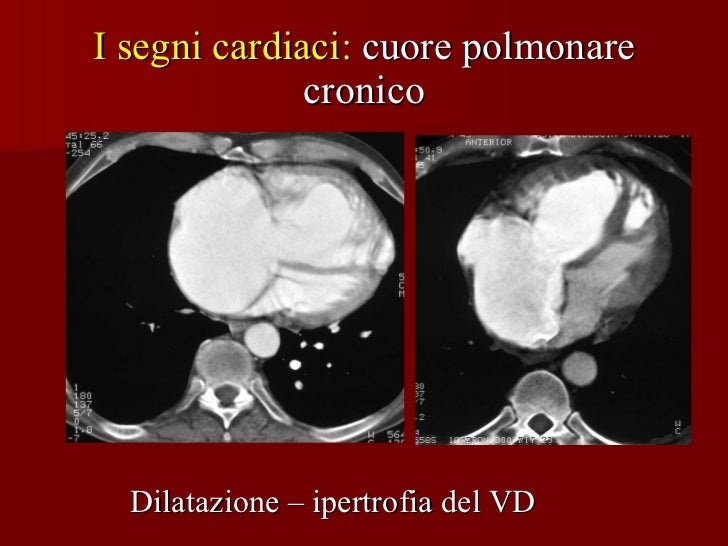 Coda I Segni Del Cuore Dove Vederlo