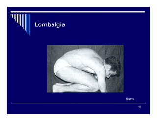 65

$#
 