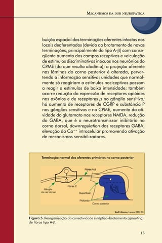 13
MECANISMOS DA DOR NEUROPÁTICA
Figura 5. Reorganização da conectividade sináptica–brotamento (sprouting)
de ﬁbras tipo A-β.
Woolf & Mannion, Lancet 1999; 353.
Terminação normal dos aferentes primários no corno posterior
buição espacial das terminações aferentes intactas nos
locais deaferentados (devido ao brotamento de novas
terminações, principalmente do tipo A-β) com conse-
qüente aumento dos campos receptivos e veiculação
de estímulos discriminativos inócuos nos neurônios do
CPME (do que resulta alodinia); a projeção aferente
nas lâminas do corno posterior é alterada, perver-
tendo a informação sensitiva; unidades que normal-
mente só reagiriam a estímulos nociceptivos passam
a reagir a estímulos de baixa intensidade; também
ocorre redução da expressão de receptores opióides
nos axônios e de receptores µ no gânglio sensitivo;
há aumento de receptores de CGRP e substância P
nos gânglios sensitivos e no CPME, aumento da ati-
vidade do glutamato nos receptores NMDA, redução
do GABA, que é o neurotransmissor inibitório no
corno dorsal, downregulation dos receptores GABA,
elevação da Ca++
intracelular promovendo ativação
de mecanismos sensibilizadores.
 