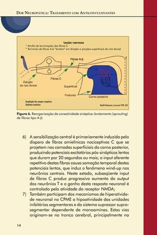 DOR NEUROPÁTICA: TRATAMENTO COM ANTICONVULSIVANTES
14
6) A sensibilização central é primariamente induzida pelo
disparo de ﬁbras amielínicas nociceptivas C que se
projetam nas camadas superﬁciais do corno posterior,
produzindo potenciais excitatórios pós-sinápticos lentos
que duram por 20 segundos ou mais; o input aferente
repetitivo destas ﬁbras causa somação temporal destes
potenciais lentos, que induz o fenômeno wind-up nos
neurônios centrais. Neste estado, subseqüente input
de ﬁbras C produz progressivo aumento do output
dos neurônios T e o ganho desta resposta neuronal é
controlado pela atividade do receptor NMDA;
7) Também participam dos mecanismos de hiperativida-
de neuronal no CPME a hipoatividade das unidades
inibitórias segmentares e do sistema supressor supra-
segmentar dependente de monoaminas. Estas vias
originam-se no tronco cerebral, principalmente na
Figura 6. Reorganização da conectividade sináptica–brotamento (sprouting)
de ﬁbras tipo A-β.
Woolf & Mannion, Lancet 1999; 353.
Lesão nervosa
* Atroﬁa de terminações das ﬁbras C
* Terminais de ﬁbras A-b “brotam” em direção a porções superﬁciais da raiz dorsal
Ampliação dos campos receptivos
Alodínea mecânica
 