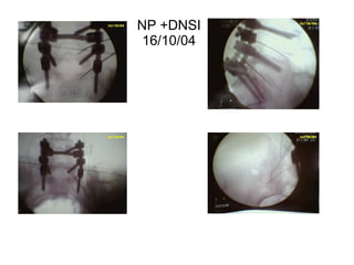 NP +DNSI 16/10/04 