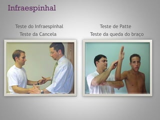 Infraespinhal
Teste do Infraespinhal Teste de Patte
Teste da Cancela Teste da queda do braço
 