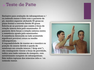 +Teste de Patte
Exclusivo para avaliação do infraespinhoso e /
ou redondo menor é feito com o paciente de
pé, membro superior abduzido 90 graus no
plano frontal e cotovelo fletido 90 graus.
Solicita-se ao paciente que resista à força de
rotação interna feita pelo examinador. O
paciente deve forçar a rotação externa contra
a resistência oposta pelo examinador.
A resistência diminuída no lado acometido
significará provável rotura no tendão
infraespinhoso.
A impossibilidade de manter-se o membro na
posição do exame devido à queda do
antebraço em rotação interna (“drop arm”),
não conseguindo vencer a força da gravidade,
indica uma lesão extensa do manguito, com
envolvimento completo do infraespinhoso.
Este indica rupturas dos músculos infra e / ou
redondo menor.
 