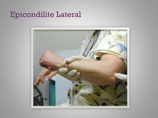 Epicondilite Lateral
 