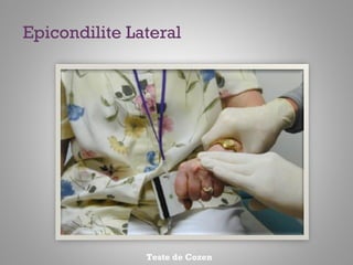 Teste de Cozen
Epicondilite Lateral
 