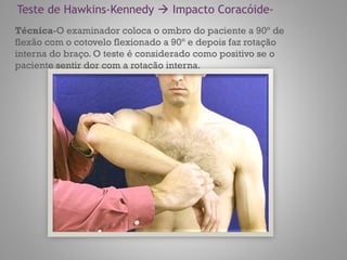 Teste de Hawkins-Kennedy  Impacto Coracóide-
Técnica-O examinador coloca o ombro do paciente a 90º de
flexão com o cotovelo flexionado a 90º e depois faz rotação
interna do braço. O teste é considerado como positivo se o
paciente sentir dor com a rotação interna.
 
