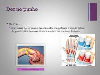 +
Dor no punho
 Caso 3:
 Secretária de 42 anos, apresenta dor em polegar e região lateral
de punho, pior ao movimento, e melhor com a imobilização.
MANOBRA DE FINKELSTEIN
 