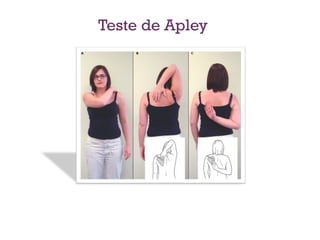 Teste de Apley
 