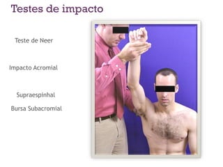 Testes de impacto
Teste de Neer
Impacto Acromial
Supraespinhal
Bursa Subacromial
 