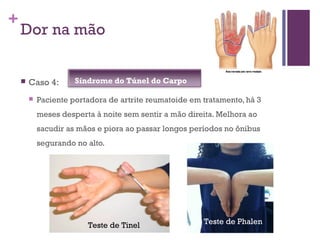 +
Dor na mão
 Caso 4:
 Paciente portadora de artrite reumatoide em tratamento, há 3
meses desperta à noite sem sentir a mão direita. Melhora ao
sacudir as mãos e piora ao passar longos períodos no ônibus
segurando no alto.
Teste de Tinel Teste de Phalen
Síndrome do Túnel do Carpo
 