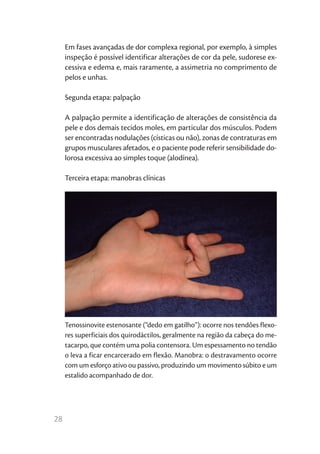 28
Em fases avançadas de dor complexa regional, por exemplo, à simples
inspeção é possível identificar alterações de cor da pele, sudorese ex-
cessiva e edema e, mais raramente, a assimetria no comprimento de
pelos e unhas.
Segunda etapa: palpação
A palpação permite a identificação de alterações de consistência da
pele e dos demais tecidos moles, em particular dos músculos. Podem
ser encontradas nodulações (císticas ou não), zonas de contraturas em
grupos musculares afetados, e o paciente pode referir sensibilidade do-
lorosa excessiva ao simples toque (alodínea).
Terceira etapa: manobras clínicas
Tenossinovite estenosante (“dedo em gatilho”): ocorre nos tendões flexo-
res superficiais dos quirodáctilos, geralmente na região da cabeça do me-
tacarpo, que contém uma polia contensora. Um espessamento no tendão
o leva a ficar encarcerado em flexão. Manobra: o destravamento ocorre
com um esforço ativo ou passivo, produzindo um movimento súbito e um
estalido acompanhado de dor.
 