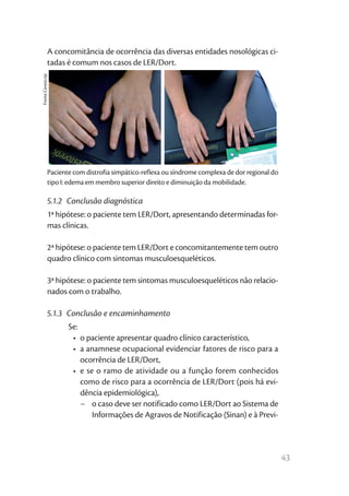 43
A concomitância de ocorrência das diversas entidades nosológicas ci-
tadas é comum nos casos de LER/Dort.
5.1.2  Conclusão diagnóstica
1ª hipótese: o paciente tem LER/Dort, apresentando determinadas for-
mas clínicas.
2ª hipótese: o paciente tem LER/Dort e concomitantemente tem outro
quadro clínico com sintomas musculoesqueléticos.
3ª hipótese: o paciente tem sintomas musculoesqueléticos não relacio-
nados com o trabalho.
5.1.3  Conclusão e encaminhamento
Se:
•	 o paciente apresentar quadro clínico característico,
•	 a anamnese ocupacional evidenciar fatores de risco para a
ocorrência de LER/Dort,
•	 e se o ramo de atividade ou a função forem conhecidos
como de risco para a ocorrência de LER/Dort (pois há evi-
dência epidemiológica),
−	 o caso deve ser notificado como LER/Dort ao Sistema de
Informações de Agravos de Notificação (Sinan) e à Previ-
Paciente com distrofia simpático-reflexa ou síndrome complexa de dor regional do
tipo I: edema em membro superior direito e diminuição da mobilidade.
FonteCerest/sp
 