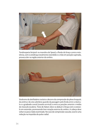 Tendinopatia biciptal: na manobra de Speed, a flexão do braço contra resis-
     tência, com o antebraço totalmente estendido e a mão em posição supinada,
     provoca dor na região anterior do ombro.




     Síndrome do desfiladeiro torácico: decorre da compressão do plexo braquial,
     da artéria e da veia subclávia quando da passagem pela fenda entre a clavícu-
     la e o gradeado costal (costela cervical) e entre as porções anterior e média
     do músculo escaleno. Teste de Adson: deve-se abduzir o braço com o cotove-
     lo em extensão, promovendo leve rotação externa do ombro. A cabeça deve
     voltar-se para o lado examinado. No caso de compressão vascular, ocorre uma
     redução na impulsão do pulso radial.



34
 