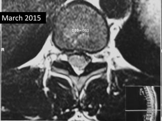 D10 – D11
March 2015
 