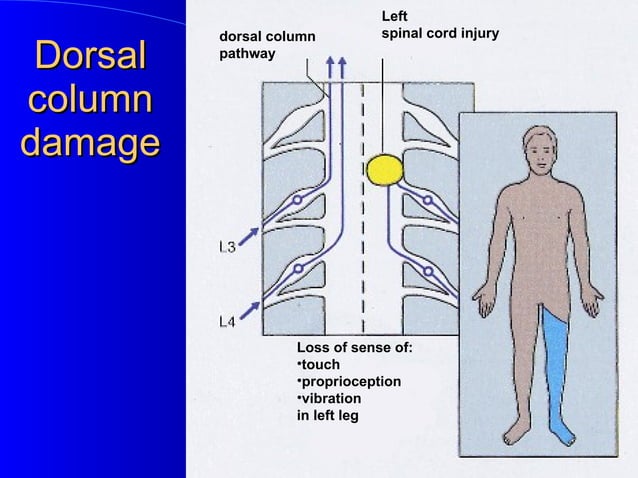 Dorsal column pathway | PPT | Operating Systems | Computer Software and ...