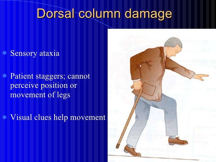 Dorsal column pathway