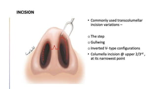 Gullwing Incision Rhinoplasty Dorsal reduction rhinoplasty by snehlata.pptx