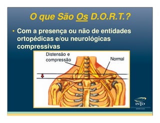 • Com a presença ou não de entidades
ortopédicas e/ou neurológicas
compressivas
• Com a presença ou não de entidades
ortopédicas e/ou neurológicas
compressivas
O que São Os D.O.R.T.?O que São Os D.O.R.T.?
 