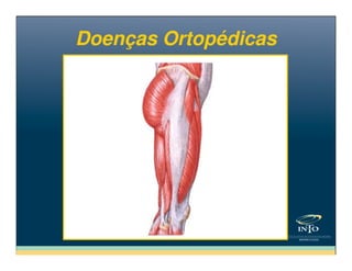 Doenças OrtopédicasDoenças Ortopédicas
 