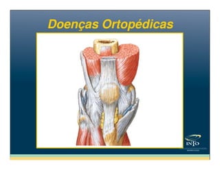 Doenças OrtopédicasDoenças Ortopédicas
 