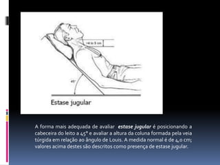 A forma mais adequada de avaliar estase jugular é posicionando a
cabeceira do leito a 45° e avaliar a altura da coluna formada pela veia
túrgida em relação ao ângulo de Louis. A medida normal é de 4,0 cm;
valores acima destes são descritos como presença de estase jugular.
 