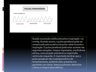 Queda na pressão sistólica durante a inspiração > 10
mmHg. Quando severo, o pulso paradoxal pode ser
comprovado pela ausência do pulso radial durante a
inspiração. O pulso paradoxal pode estar ausente nas
seguintes situações: choque importante, insuficiência
aórtica, comunicação interatrial ou hipertrofia
ventricular esquerda. É importante lembrar que o
pulso paradoxal não é patognomônico de
tamponamento, podendo estar presente nos
pacientes com asma, doença pulmonar obstrutiva
crônica e choque hipovolêmico.
 
